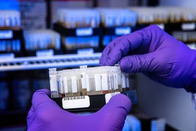 These patients’ samples were to be tested for SARS-CoV-2 antibodies, using