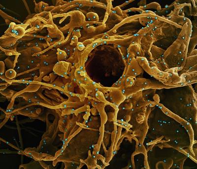 Novel Coronavirus SARS-CoV-2 Colorized scanning electron micrograph of a cell