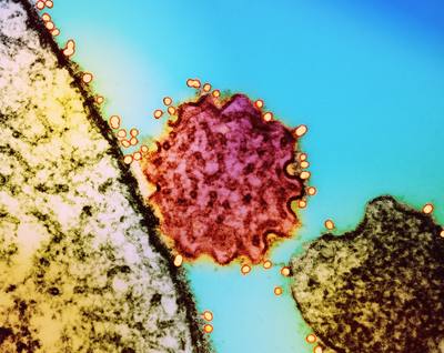 Nipah Virus Particle Colorized transmission electron micrograph of a single