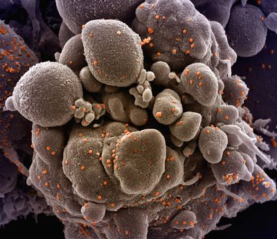 Novel Coronavirus SARS-CoV-2 Colorized scanning electron micrograph of an
