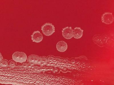 Colonies of Campylobacter rectus on BHK agar medium.