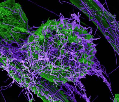 Ebola Virus Particles Scanning electron micrograph of Ebola virus particles