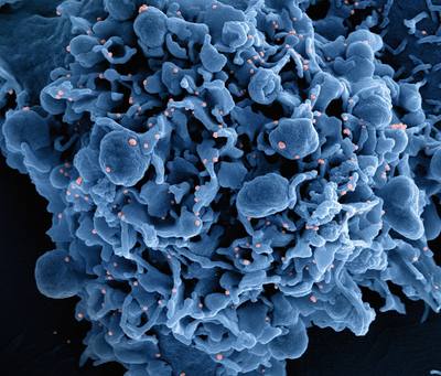 Novel Coronavirus SARS-CoV-2 Colorized scanning electron micrograph of a cell